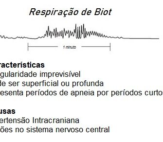 ) de Biot ou atáxica. Item errado. Irregularidade imprevisível, podendo ser superficial ou profunda e para por períodos curtos.