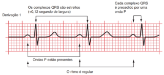 O Que Eletrocardiograma Como Realizar A Leitura