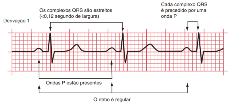 O que é eletrocardiograma? Como realizar a leitura?